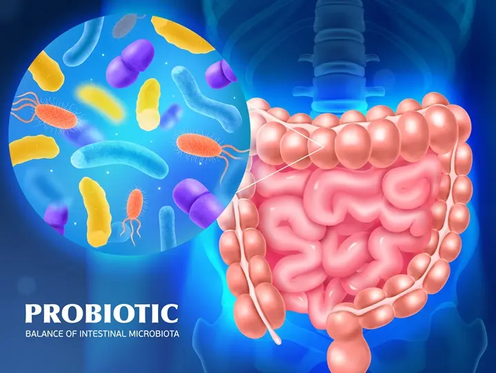 2111-i305-013-S-m005-c13-realistic20human20colon20bacterial Hisztamin intolerancia: Tünetek, okok és diéta Emésztés 
