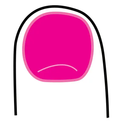 3-korom-koromerosito-haj-bor-vitamin-koromtoredezes-koromapolas Mit árul el személyiségedről a körmöd formája? Szépség 