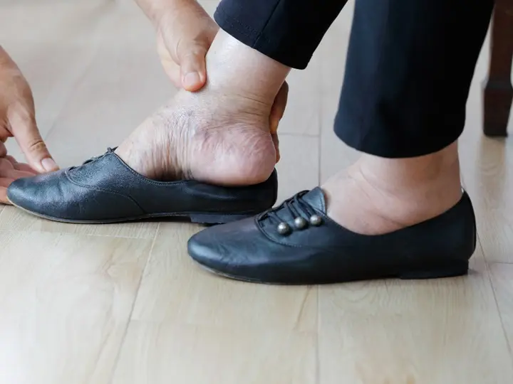 361 Ödéma ellen: A legjobb természetes módszerek Méregtelenítés 