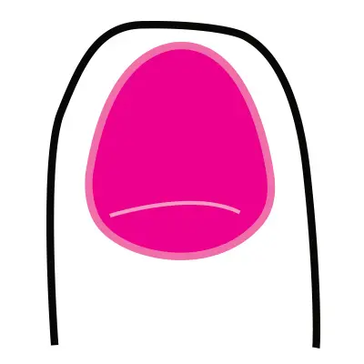 4-korom-koromapolas-haj-bor-vitamin-koromtoredezes-koromerosito Mit árul el személyiségedről a körmöd formája? Szépség 