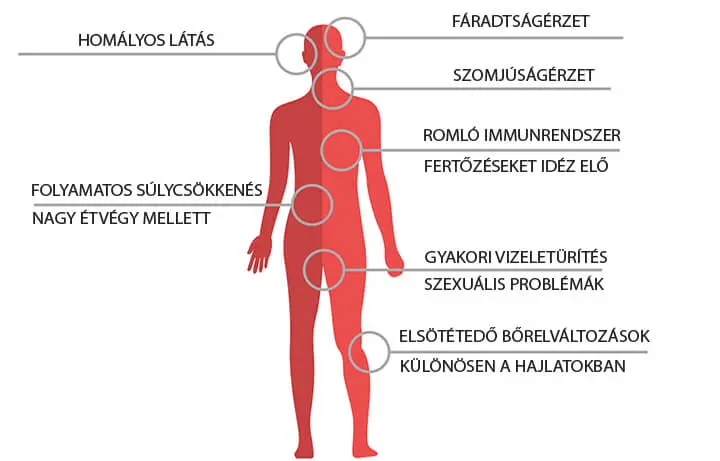 4cukorbetegseg-kialakulasa-tunetek-rizikofaktorok A cukorbetegség kezelése természetes módon Hormontámogatás 