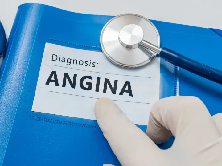 angina-pectoris-tunetei Mi az Angina pectoris? Immunrendszer 