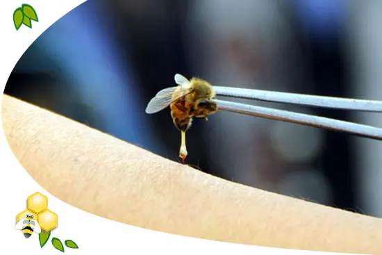 apiterapia-propolisz-gyulladas-mehpempo-immunrendszer-immunterapia Mit jelent az, hogy APITERÁPIA? Immunrendszer 