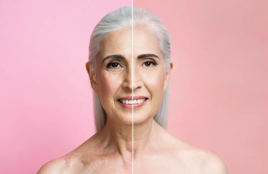 before-after-portrait-mature-woman-retouched Természetes ránctalanítás májméregtelenítéssel? Szépség 