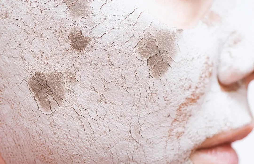 clay-facial-mask-female-face-close-up Öregségi foltok: Mit tehetünk ellene? Sejtvédelem 