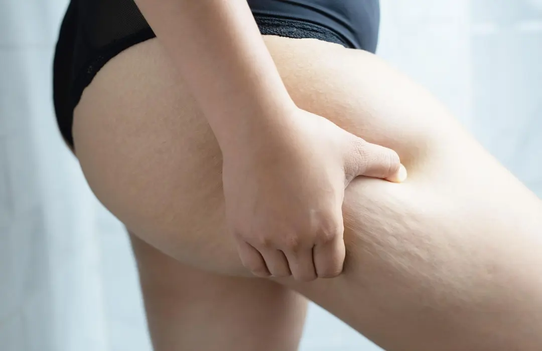 comb Tippek a gyönyörű lábakért Szépség 