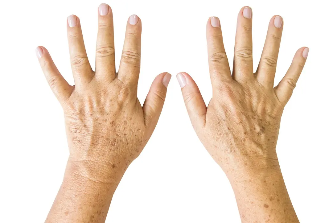 cropped-hands-woman-gesturing-against-white-background Öregségi foltok: Mit tehetünk ellene? Sejtvédelem 
