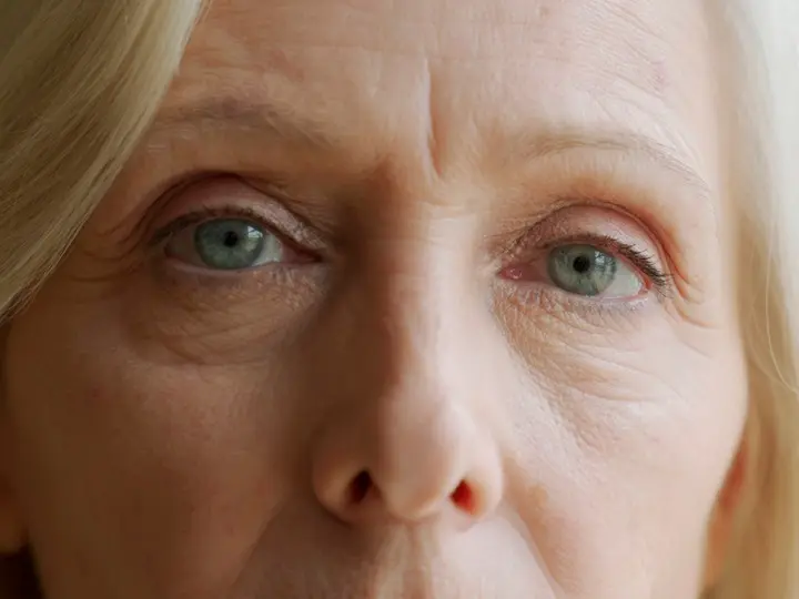face-eyes-old-woman-large-wrinkles-old-woman-s-face-face-close-up Időskori szembetegségek megelőzése Sejtvédelem 