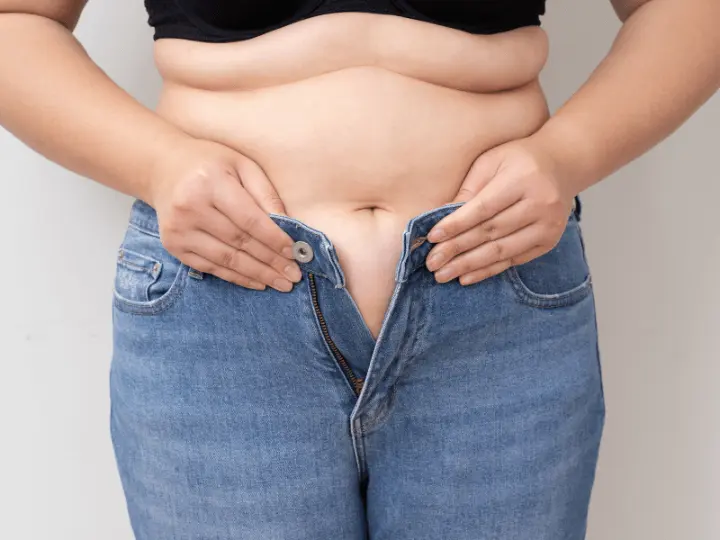 hogyan-keletkezik-a-pocak201 Lapos has – több mint esztétika Testsúlycsökkentés 