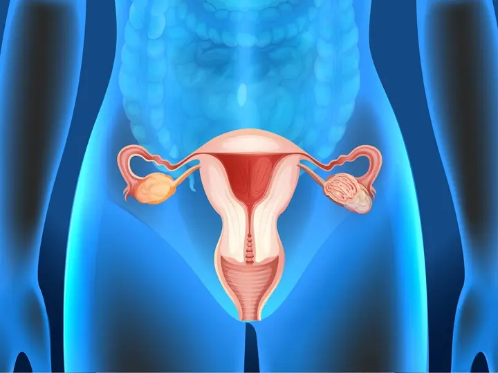 hormonalis-problemak Női hormonális problémák és megoldások Hormontámogatás 