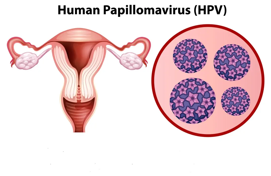 ijki_7q0t_230210 Diszplázia ellen gyulladáscsökkentő étrenddel Sejtvédelem 