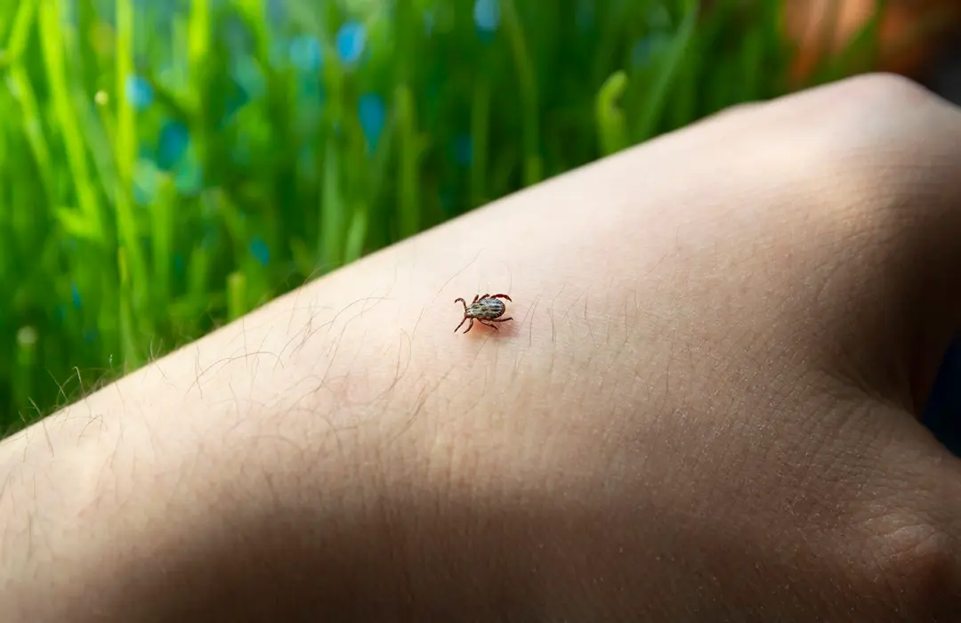 infected-dangerous-tick-human-skin-carrier-infections-viruses-parasitic-mite Tények és tévhitek a Lyme-kórról Sejtvédelem 