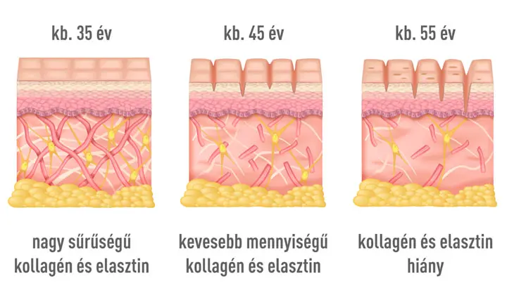 kollagen-hialurionsav-oregszik201 A hialuronsav és a kollagén hatása a megereszkedett bőrre Szépség 