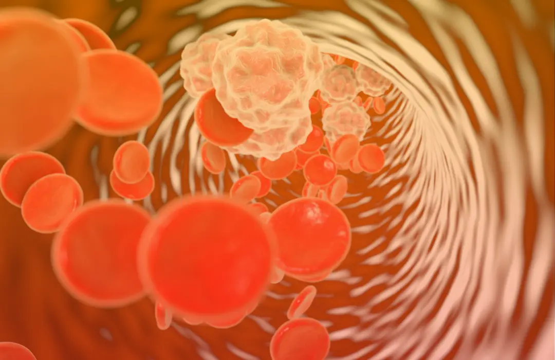 kronikus20gyulladas_micellas_kurkuma Hogyan segíti a kurkuma az immunegyensúlyt? Immunrendszer 