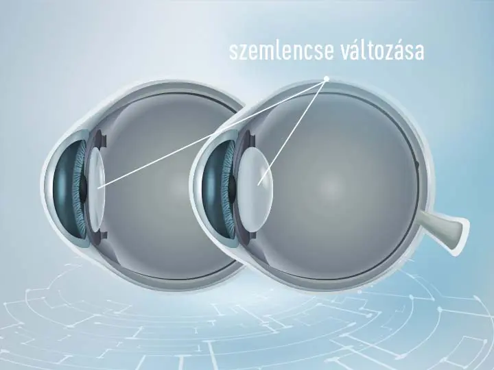 lutein-pro-digitalis-szemfaradtsag-es-kek-feny-blog-kep-1200x900px-no2 Digitális szemfáradtság és a kék fény Uncategorized 