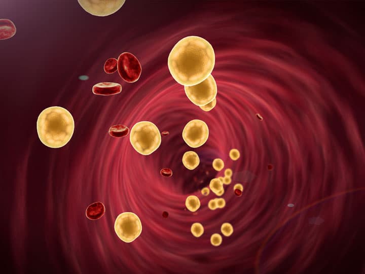 magas-koleszterinszint-csokkentese-fokhagyma201 Csökkentsd a magas koleszterinszintet természetes módon! Immunrendszer 