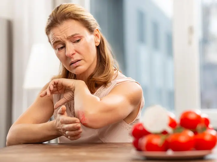 mature-blond-haired-woman-with-sensitive-skin-having-strong-allergy-some-food Hisztamin intolerancia: Tünetek, okok és diéta Emésztés 