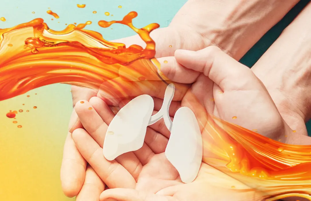 micellas_kurkuma_jobb_felszivodas Kurkuma: természetes védelem a szmog ellen Szupertápanyagok 