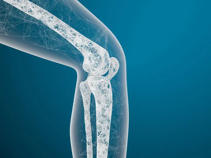 oliva-k2-d3-vitamin-erelmeszesedes-csontritkulas-csont Mire jó az olíva olajos K2 és D3-vitamin? Immunrendszer 