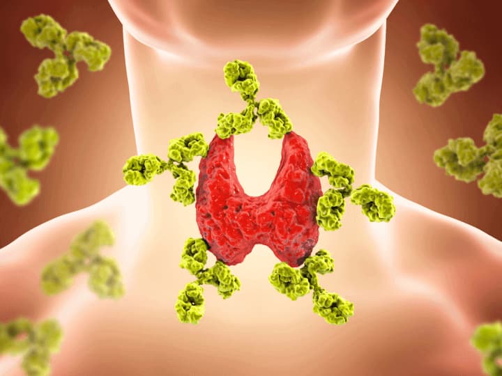 pajzsmirigy-alulmukodes-mit-jelent Természetesen a pajzsmirigy-alulműködés ellen! Hormontámogatás 