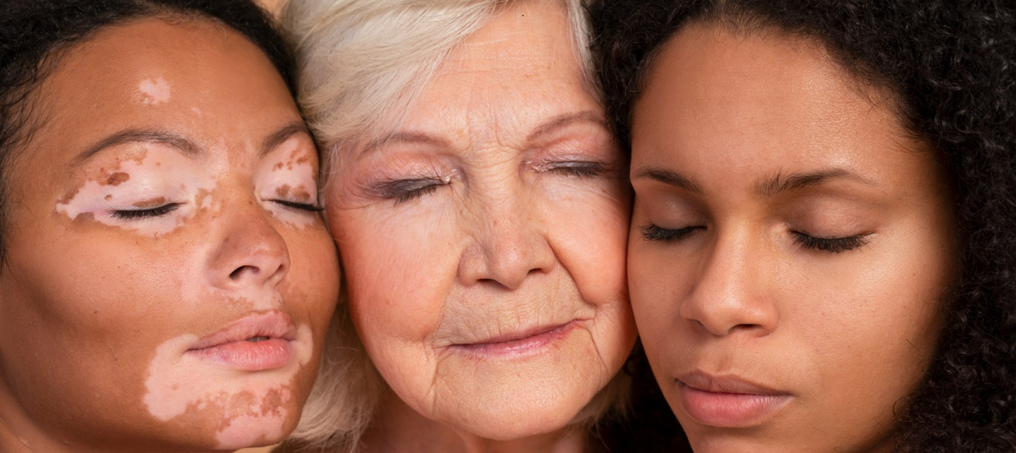 pigbo-1 Természetes UV-védelem belülről, tápanyagokkal Sejtvédelem 