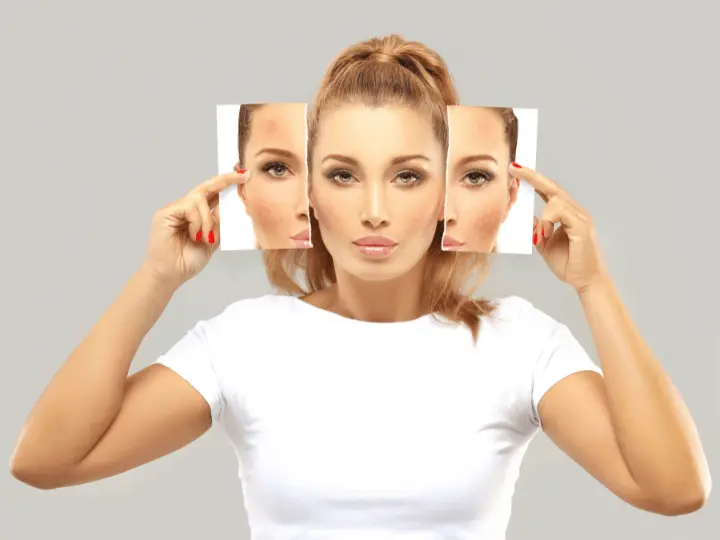 pigmentfolt-majfolt-halvanyitasa-kivulrol Természetes megoldások májfolt, pigmentfolt ellen Szépség 