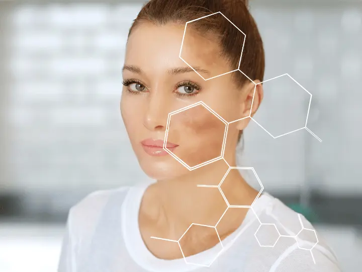 pigmentfolt-majfolt-oka Természetes megoldások májfolt, pigmentfolt ellen Szépség 