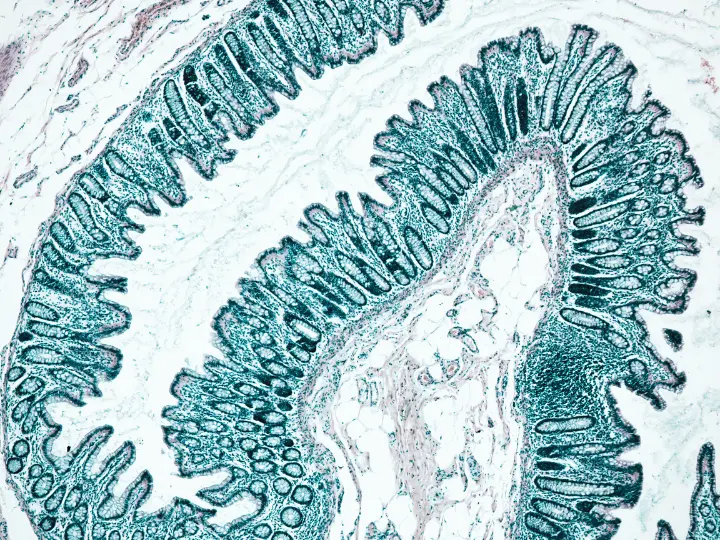 szekrekedes-termeszetes-kezeles-prebiotikum-belflora-belbolyhok A székrekedés oka és természetes kezelése prebiotikumokkal Emésztés 