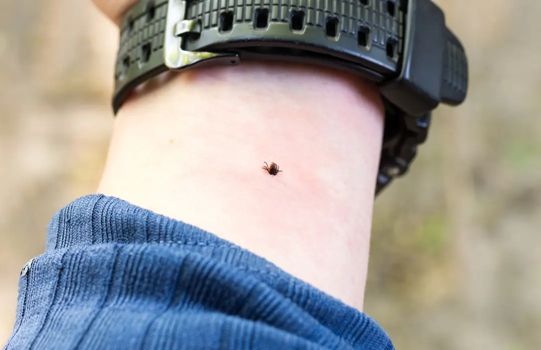 tick-bites-his-hand-mite-skin-hand-man-tick-forest Tények és tévhitek a Lyme-kórról Sejtvédelem 
