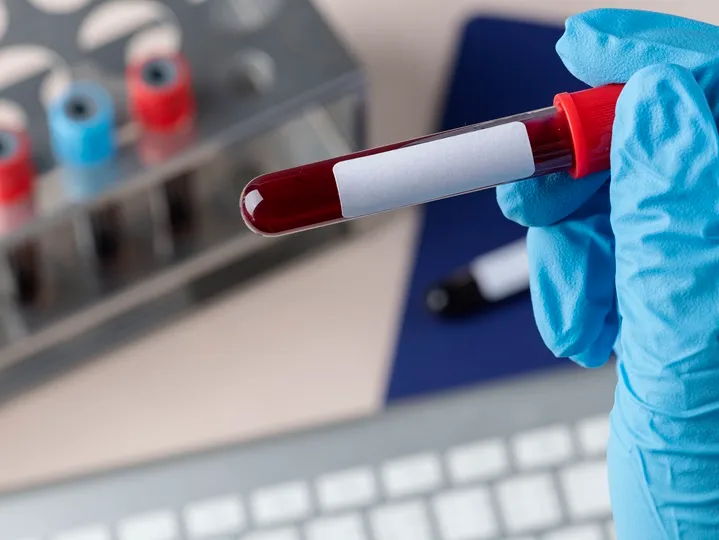 verteszt-vitaminhiany201 A vitamin- és ásványianyag-hiány tünetei és kezelési módjai – Minden, amit tudni érdemes! Szupertápanyagok 