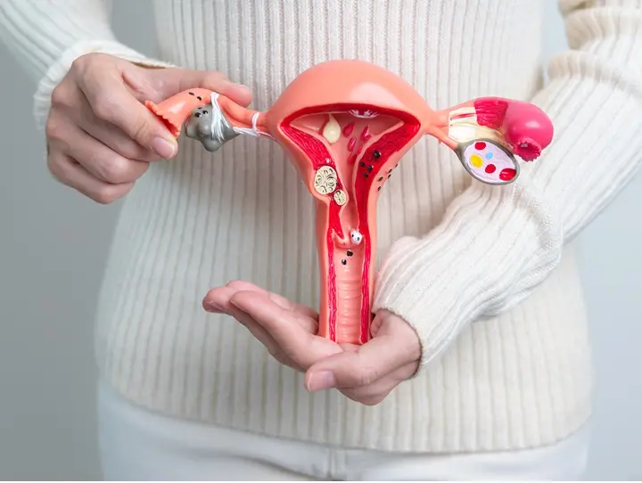 woman-holding-uterus-ovaries-model-ovarian-cervical-cancer-cervix-diso PCOS diéta: Így étkezz, a hormonális egyensúlyért! Hormontámogatás 