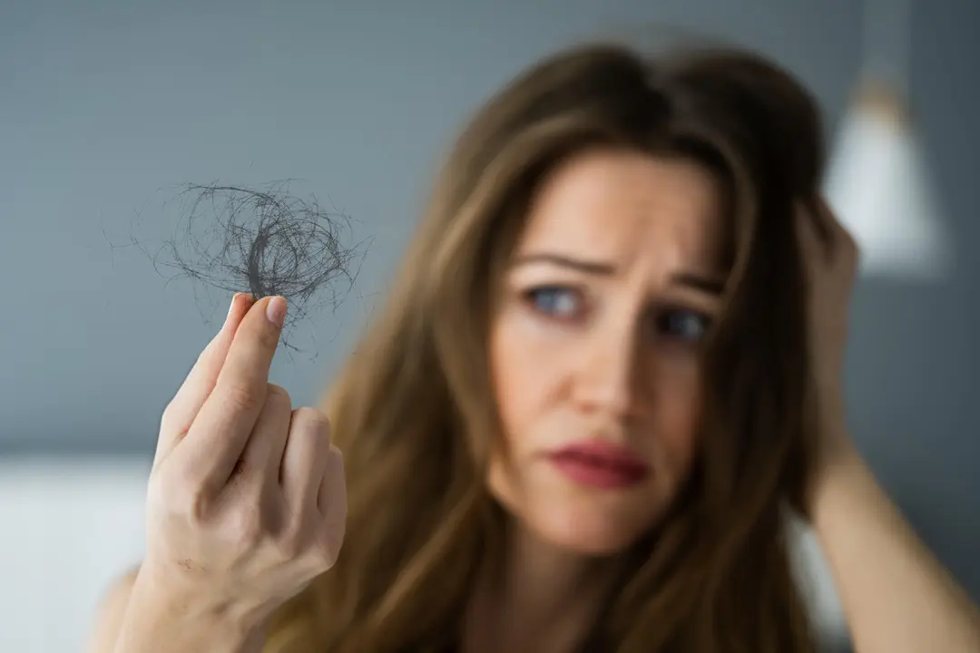 young-woman-holding-loss-hair Szezonális hajhullás: mit tehetsz ellene? Szépség 